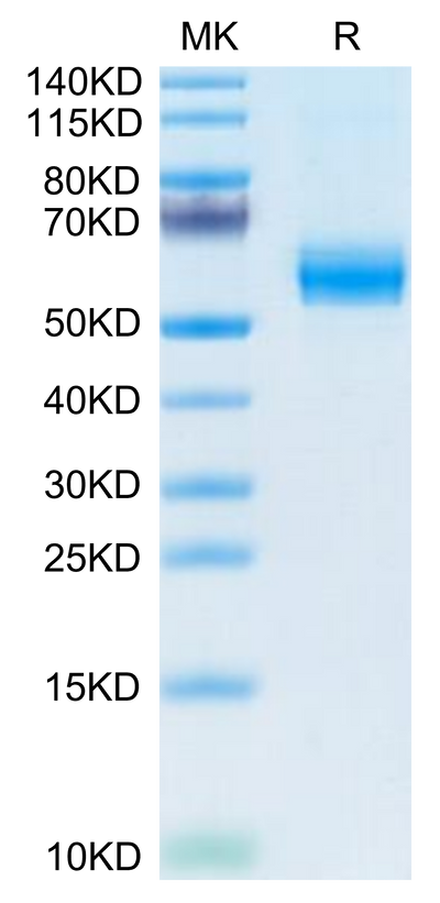Mouse PLA2G7 on Tris-Bis PAGE under reduced condition. The purity is greater than 95%.Recombinant Mouse PLA2G7 Protein