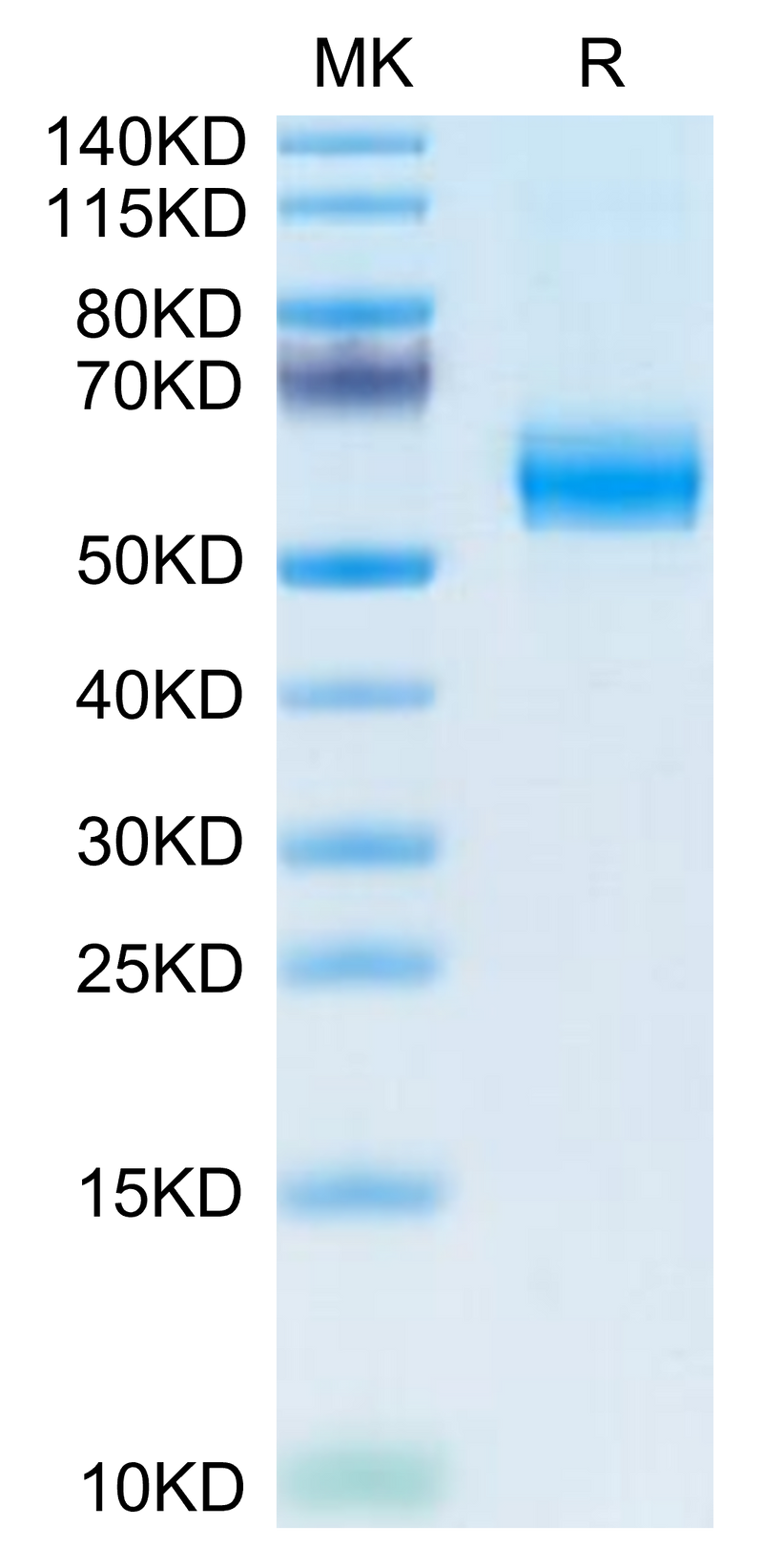 Mouse PLA2G7 on Tris-Bis PAGE under reduced condition. The purity is greater than 95%.Recombinant Mouse PLA2G7 Protein