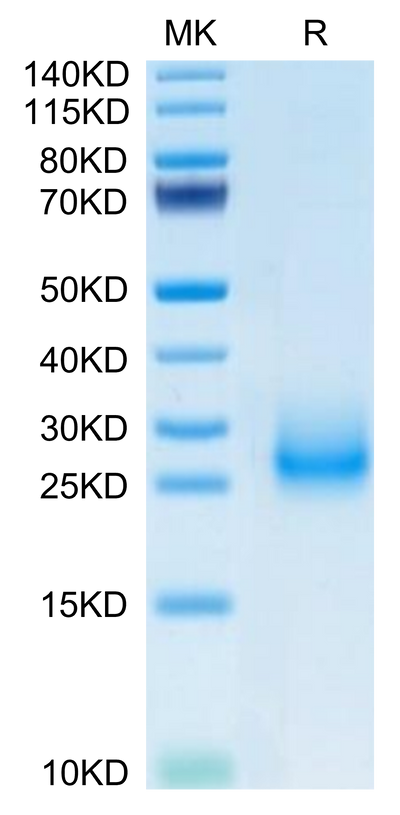 Mouse CD7 on Tris-Bis PAGE under reduced condition. The purity is greater than 95%.Recombinant Mouse CD7 Protein