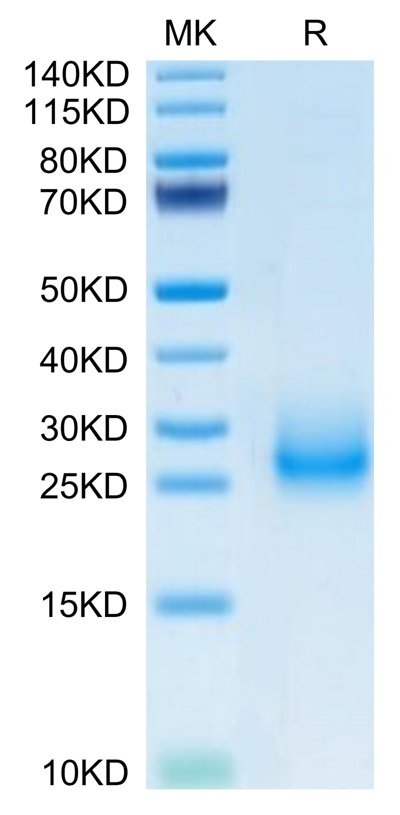 Mouse CD7 on Tris-Bis PAGE under reduced condition. The purity is greater than 95%.Recombinant Mouse CD7 Protein