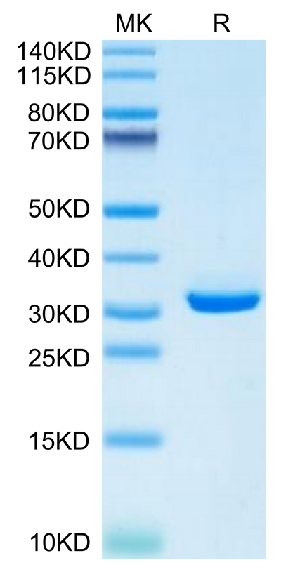 Mouse APOE on Tris-Bis PAGE under reduced condition. The purity is greater than 95%.Recombinant Mouse APOE/Apolipoprotein E Protein, Active