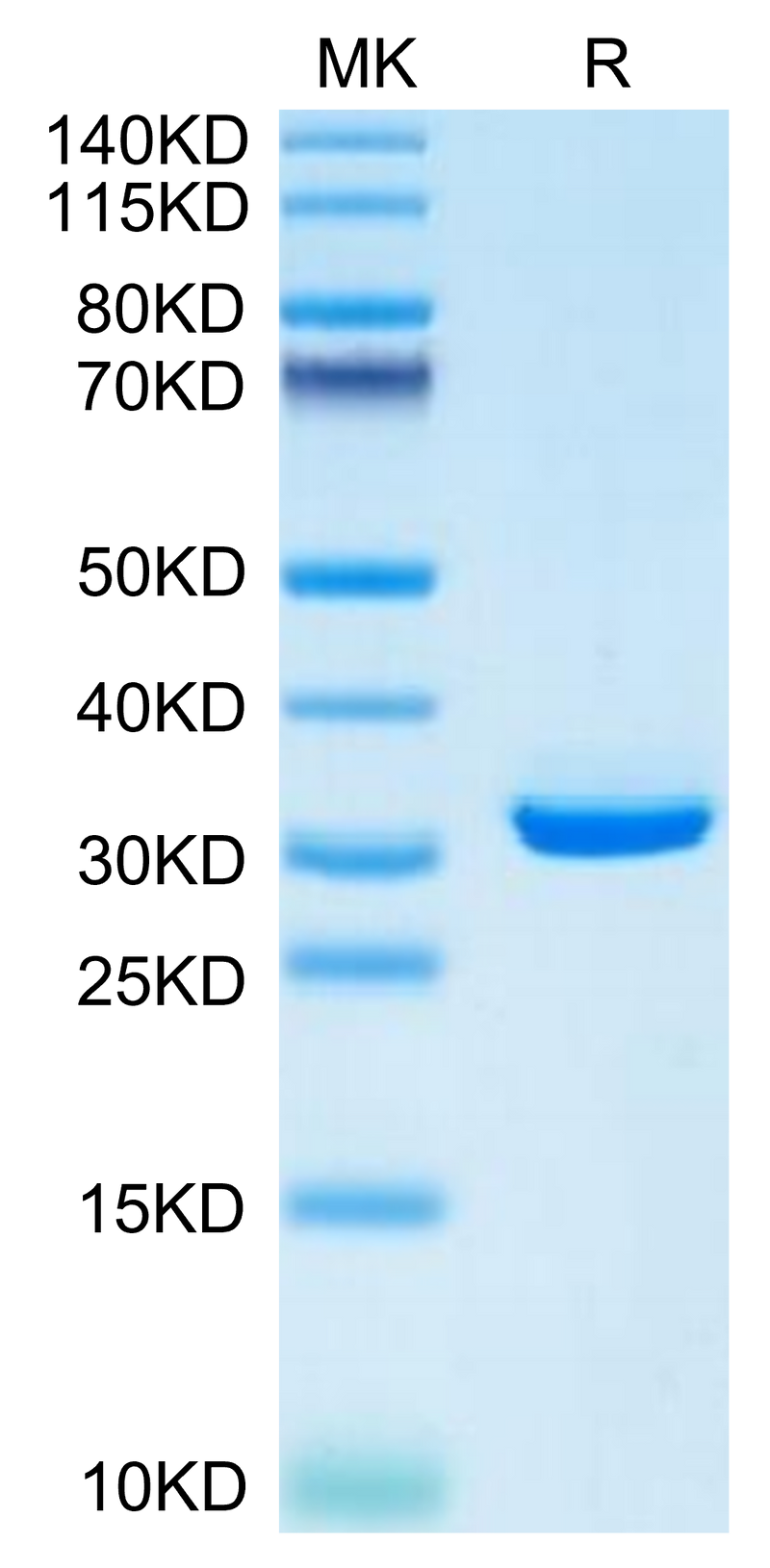 Mouse APOE on Tris-Bis PAGE under reduced condition. The purity is greater than 95%.Recombinant Mouse APOE/Apolipoprotein E Protein, Active