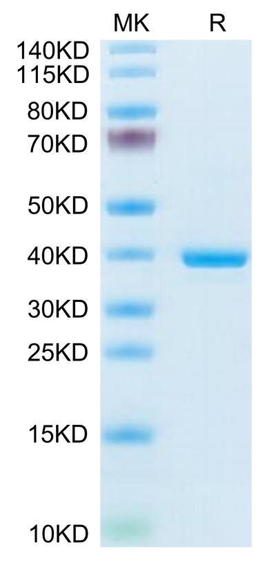 Mouse ANXA1 on Tris-Bis PAGE under reduced condition. The purity is greater than 95%.Recombinant Mouse ANXA1 Protein