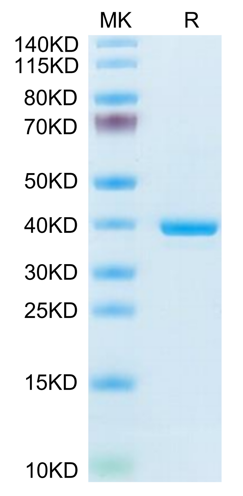 Mouse ANXA1 on Tris-Bis PAGE under reduced condition. The purity is greater than 95%.Recombinant Mouse ANXA1 Protein