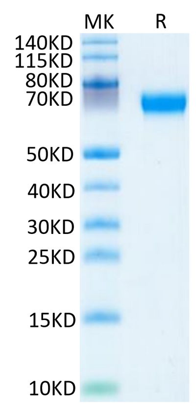 Mouse HPX on Tris-Bis PAGE under reduced condition. The purity is greater than 95%.Recombinant Mouse HPX Protein