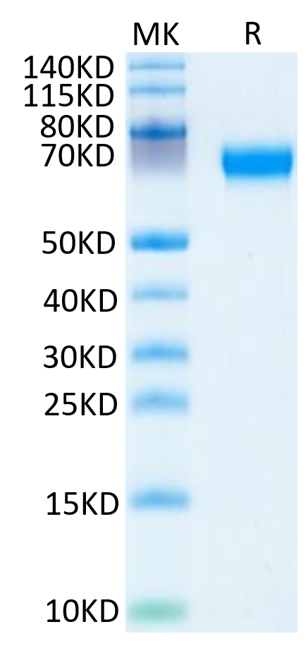 Mouse HPX on Tris-Bis PAGE under reduced condition. The purity is greater than 95%.Recombinant Mouse HPX Protein