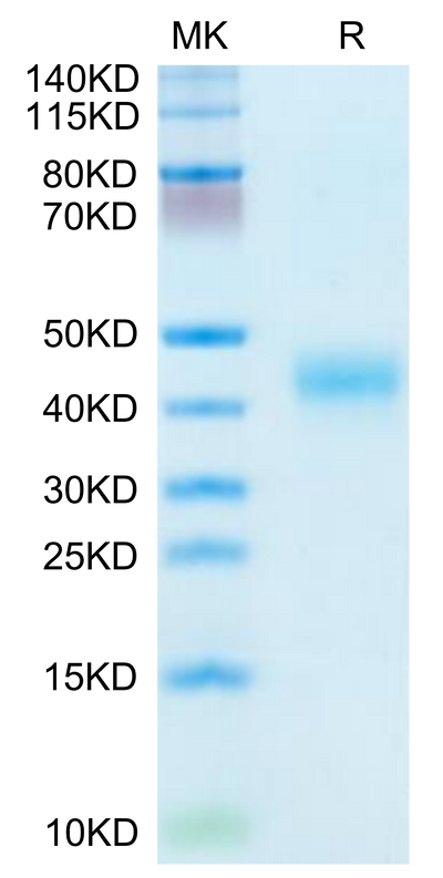 Human Kallikrein 5 on Tris-Bis PAGE under reduced condition. The purity is greater than 95%.Recombinant Human Kallikrein 5/KLK5 Protein, Active