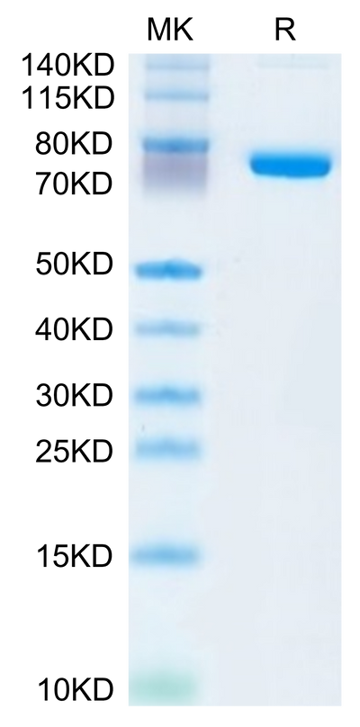 Human SEMA7A on Tris-Bis PAGE under reduced condition. The purity is greater than 95%.Recombinant Human SEMA7A Protein