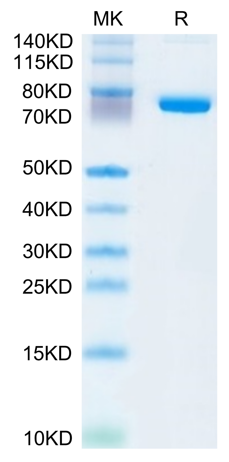 Human SEMA7A on Tris-Bis PAGE under reduced condition. The purity is greater than 95%.Recombinant Human SEMA7A Protein