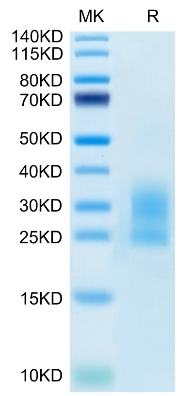 Mouse NKG2D on Tris-Bis PAGE under reduced condition. The purity is greater than 95%.Recombinant Mouse NKG2D/CD314 Protein, Active