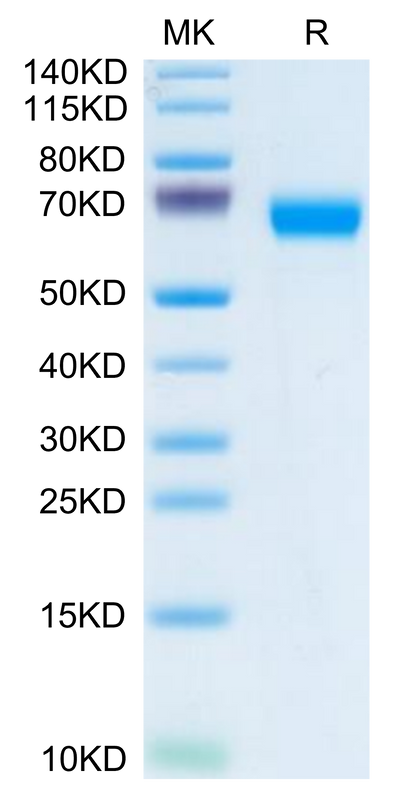 Human LCAT on Tris-Bis PAGE under reduced condition. The purity is greater than 95%.Recombinant Human LCAT Protein, Active