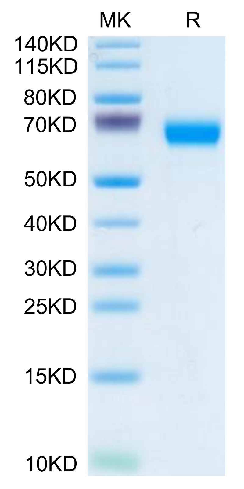 Human LCAT on Tris-Bis PAGE under reduced condition. The purity is greater than 95%.Recombinant Human LCAT Protein, Active