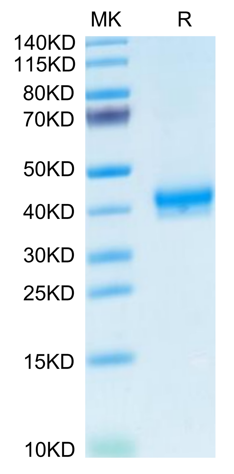 Human CADM3 on Tris-Bis PAGE under reduced condition. The purity is greater than 95%.Recombinant Human CADM3 Protein