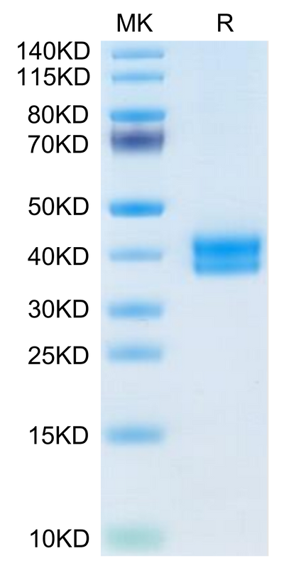 Mouse CADM3 on Tris-Bis PAGE under reduced condition. The purity is greater than 95%.Recombinant Mouse CADM3 Protein