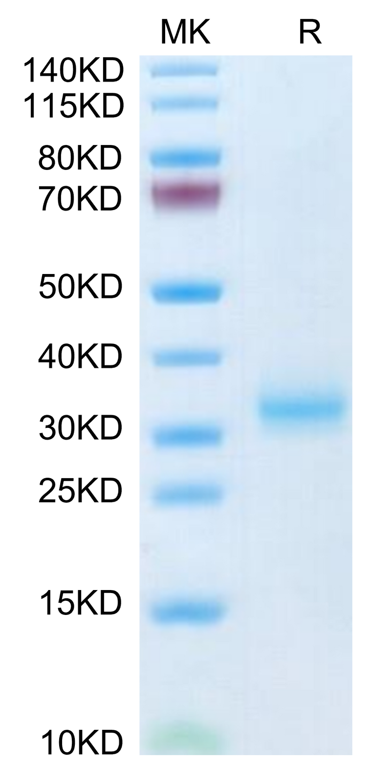 Mouse Adiponectin/Acrp30 on Tris-Bis PAGE under reduced condition. The purity is greater than 95%.Recombinant Mouse Adiponectin/Acrp30 Protein