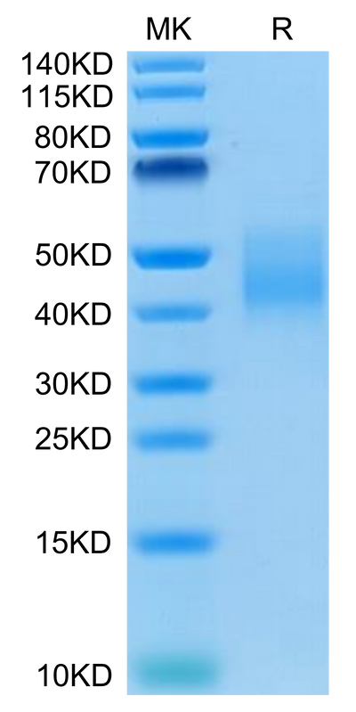 Human IL-10 R alpha on Tris-Bis PAGE under reduced condition. The purity is greater than 95%.Recombinant Human IL-10 R alpha Protein, Active