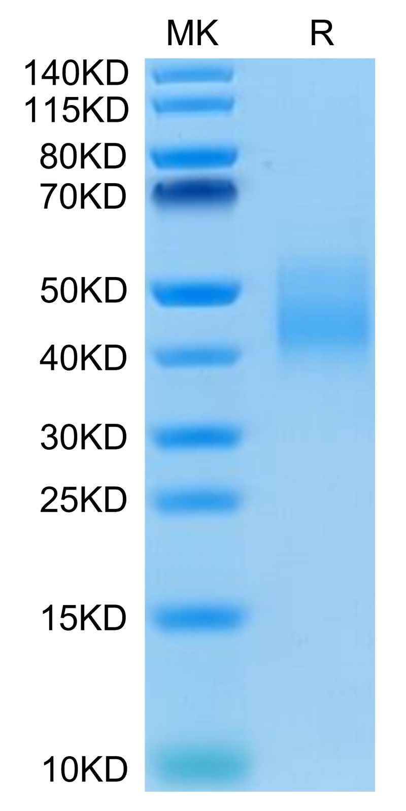 Human IL-10 R alpha on Tris-Bis PAGE under reduced condition. The purity is greater than 95%.Recombinant Human IL-10 R alpha Protein, Active