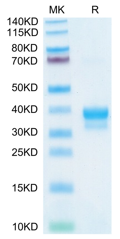 Cynomolgus IgE on Tris-Bis PAGE under reduced condition. The purity is greater than 95%.Recombinant Cynomolgus IgE Protein, Active