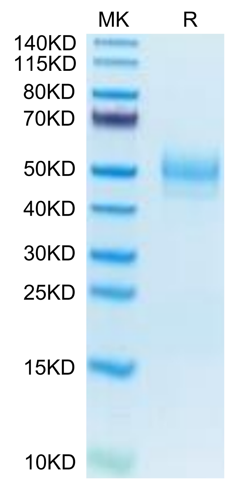 Mouse MARCO on Tris-Bis PAGE under reduced condition. The purity is greater than 95%.Recombinant Mouse MARCO Protein