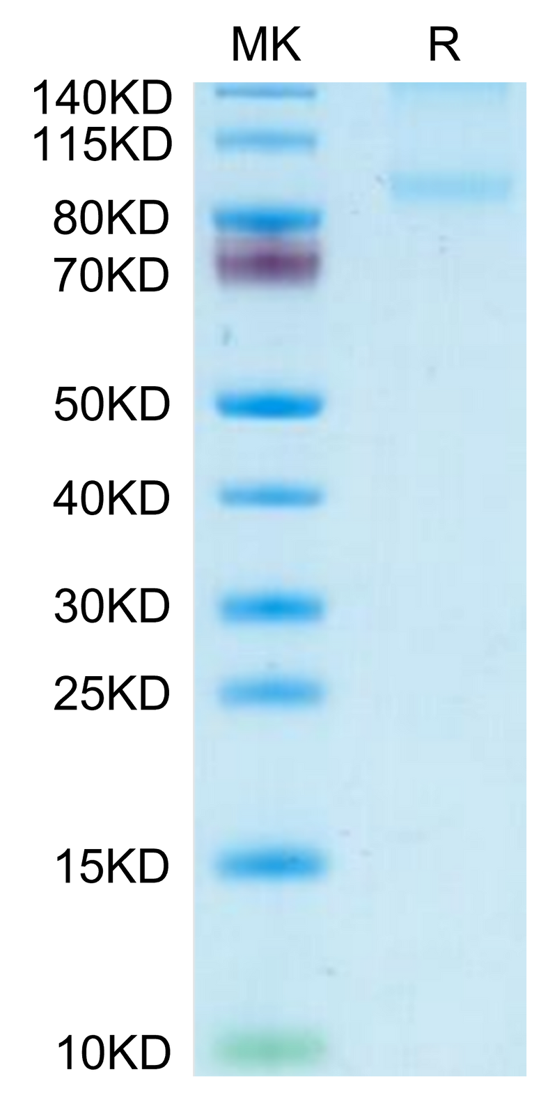 Mouse CD31/PECAM-1 on Tris-Bis PAGE under reduced condition. The purity is greater than 95%.Recombinant Mouse CD31/PECAM-1 Protein