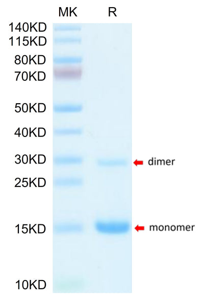Mouse S100A9 on Tris-Bis PAGE under reduced condition. The purity is greater than 95%.Recombinant Mouse S100A9/MRP14 Protein