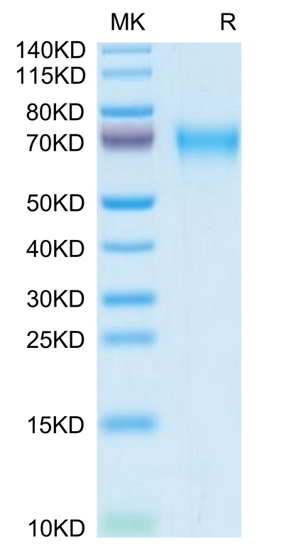 Mouse LCAT on Tris-Bis PAGE under reduced condition. The purity is greater than 95%.Recombinant Mouse LCAT Protein