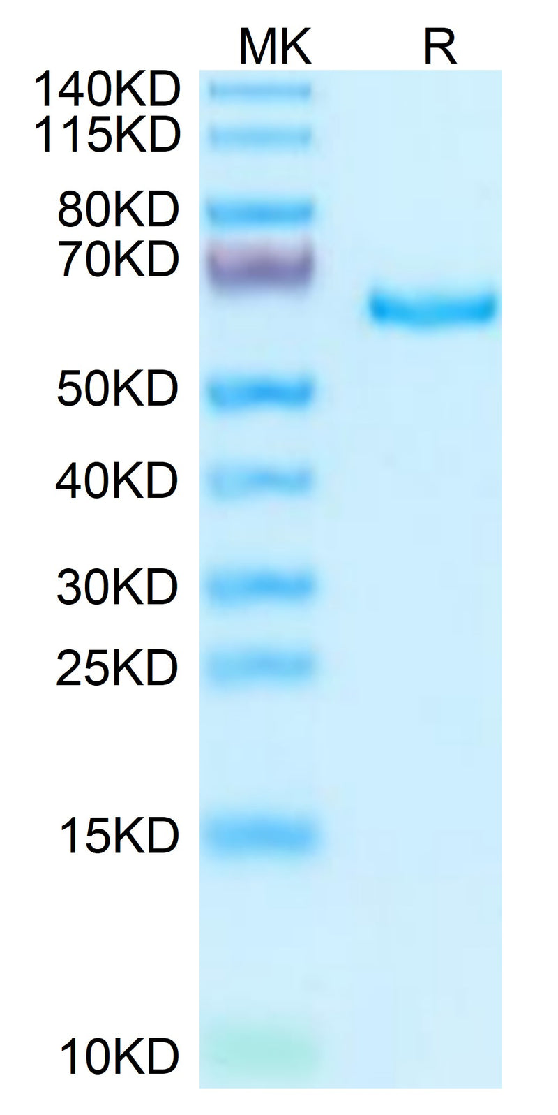 Human SEMA3A on Tris-Bis PAGE under reduced condition. The purity is greater than 95%.Recombinant Human SEMA3A Protein, Active