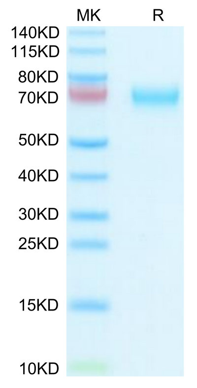 Human HPX on Tris-Bis PAGE under reduced condition. The purity is greater than 95%.Recombinant Human HPX Protein