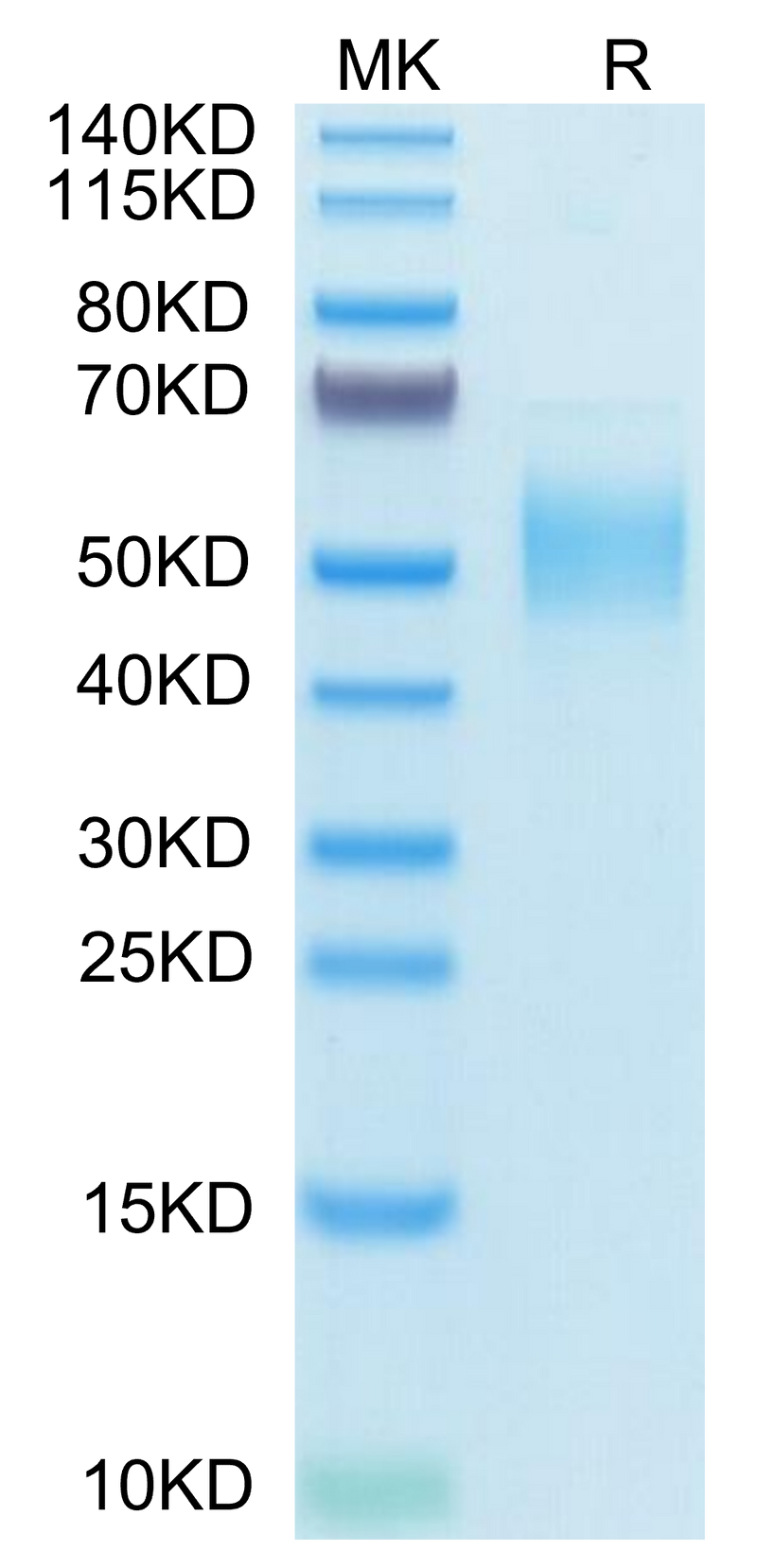 Human PLA2G7 on Tris-Bis PAGE under reduced condition. The purity is greater than 95%.Recombinant Human PLA2G7 Protein