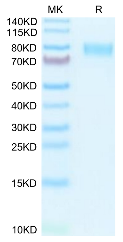 Mouse M-CSF R on Tris-Bis PAGE under reduced condition. The purity is greater than 95%.Recombinant Mouse M-CSF R/CSF1R/CD115 Protein, Active