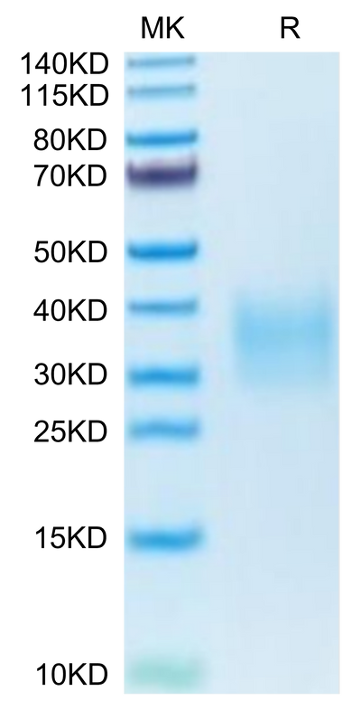 Mouse TRAIL R2 on Tris-Bis PAGE under reduced condition. The purity is greater than 95%.Recombinant Mouse TRAIL R2/DR5/TNFRSF10B Protein, Active