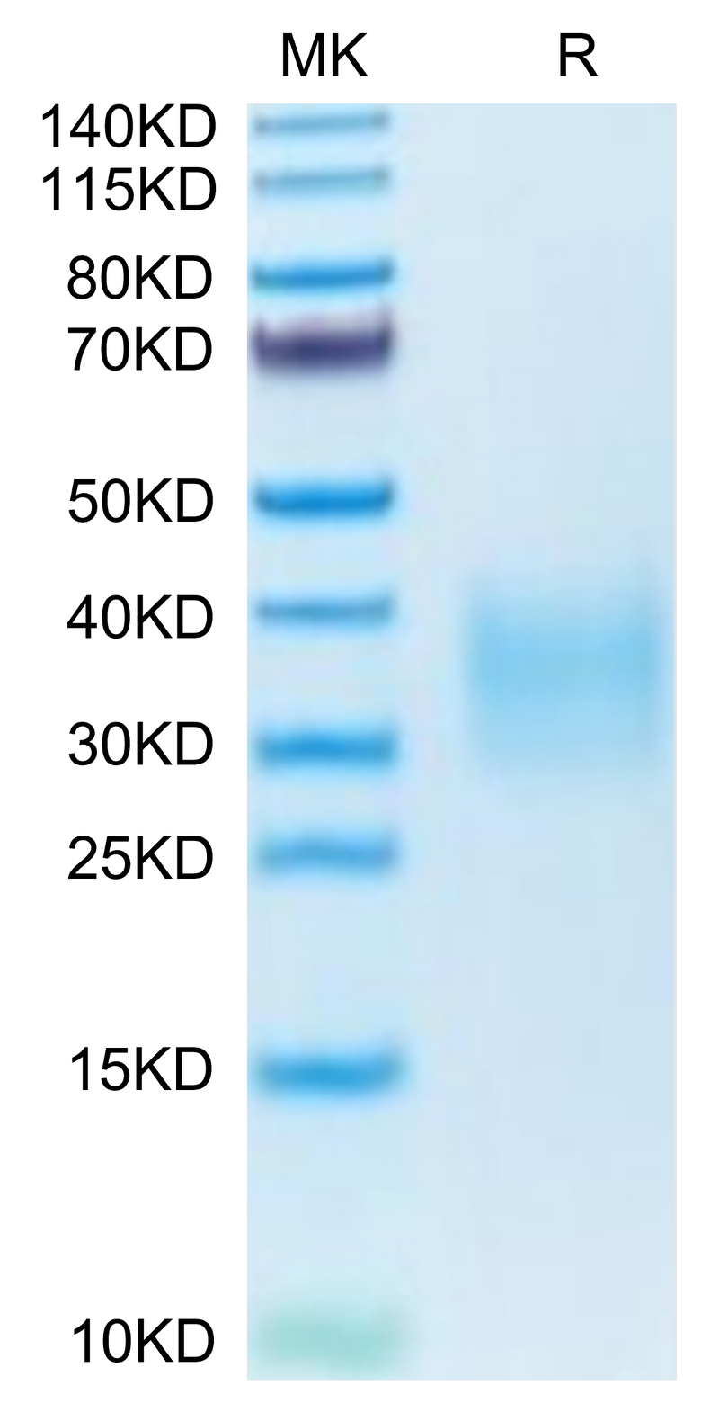 Mouse TRAIL R2 on Tris-Bis PAGE under reduced condition. The purity is greater than 95%.Recombinant Mouse TRAIL R2/DR5/TNFRSF10B Protein, Active