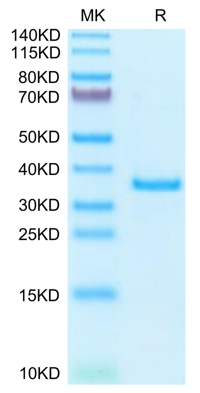 Human SFRP2 on Tris-Bis PAGE under reduced condition. The purity is greater than 95%.Recombinant Human SFRP2 Protein