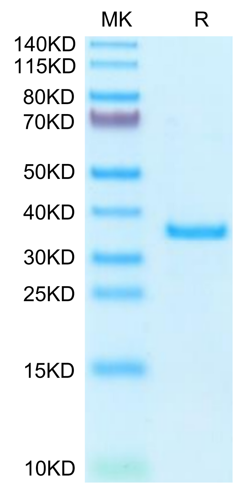 Human SFRP2 on Tris-Bis PAGE under reduced condition. The purity is greater than 95%.Recombinant Human SFRP2 Protein
