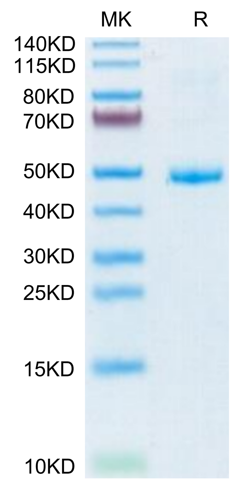Human CD42a on Tris-Bis PAGE under reduced condition. The purity is greater than 95%.Recombinant Human CD42a/GP9 Protein