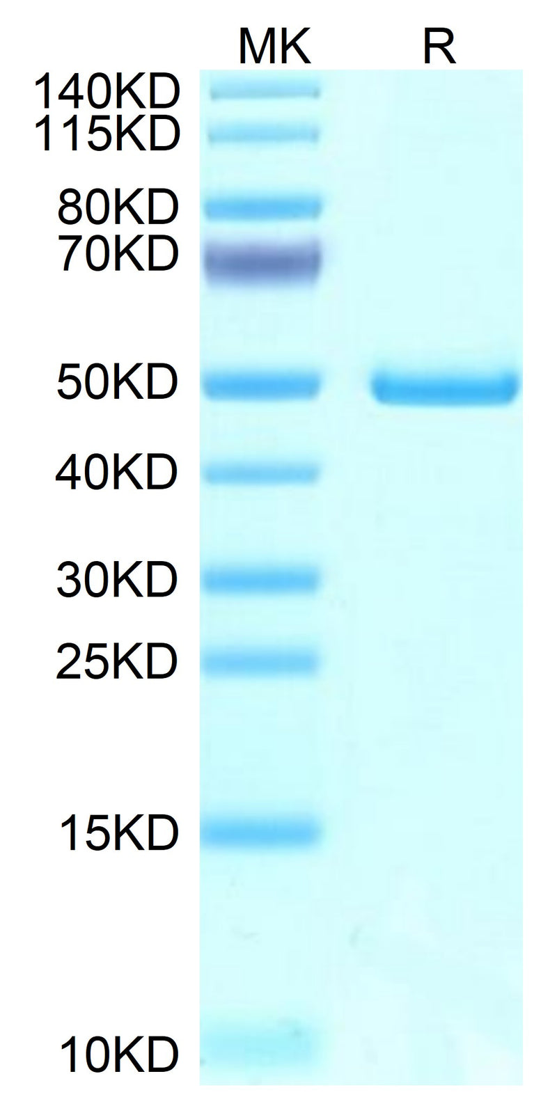 Mouse NTS1 on Tris-Bis PAGE under reduced condition. The purity is greater than 95%.Recombinant Mouse NTS1 Protein