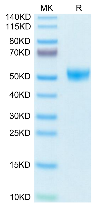 Mouse TIGIT-on Tris-Bis PAGE under reduced condition. The purity is greater than 95%.Recombinant Mouse TIGIT-Protein, Active