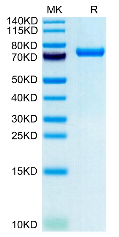 Human CLEC2D on Tris-Bis PAGE under reduced condition. The purity is greater than 95%.Recombinant Human CLEC2D Protein
