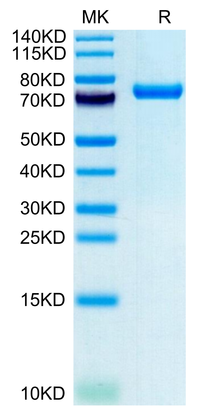 Human CLEC2D on Tris-Bis PAGE under reduced condition. The purity is greater than 95%.Recombinant Human CLEC2D Protein