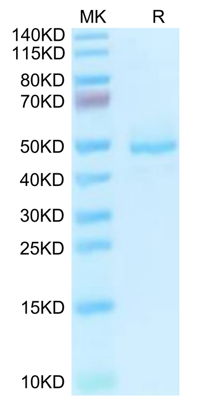 Human GP1BB on Tris-Bis PAGE under reduced condition. The purity is greater than 95%.Recombinant Human GP1BB Protein