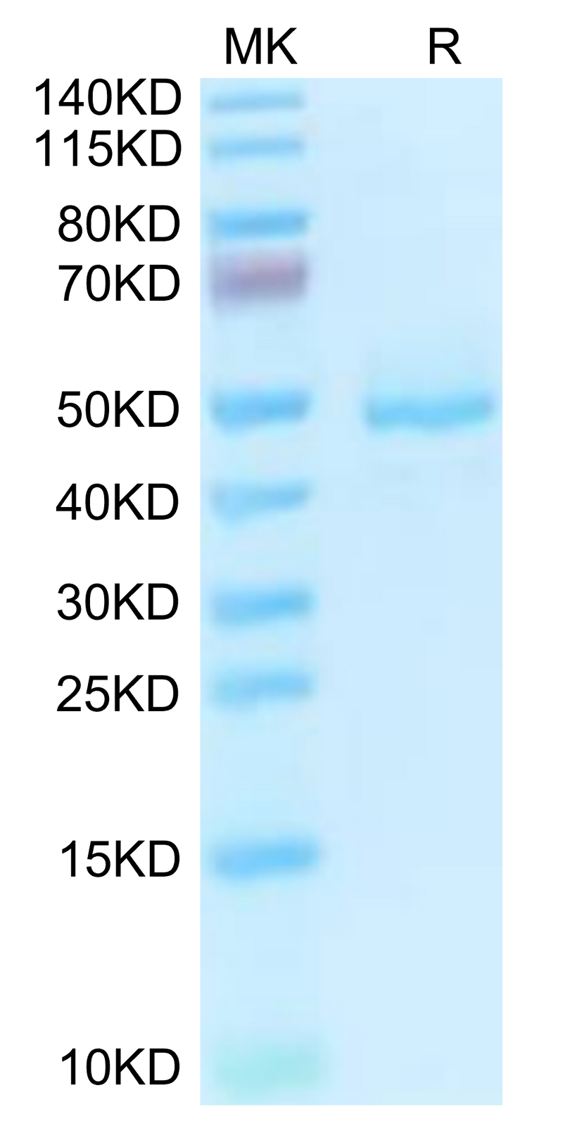 Human GP1BB on Tris-Bis PAGE under reduced condition. The purity is greater than 95%.Recombinant Human GP1BB Protein