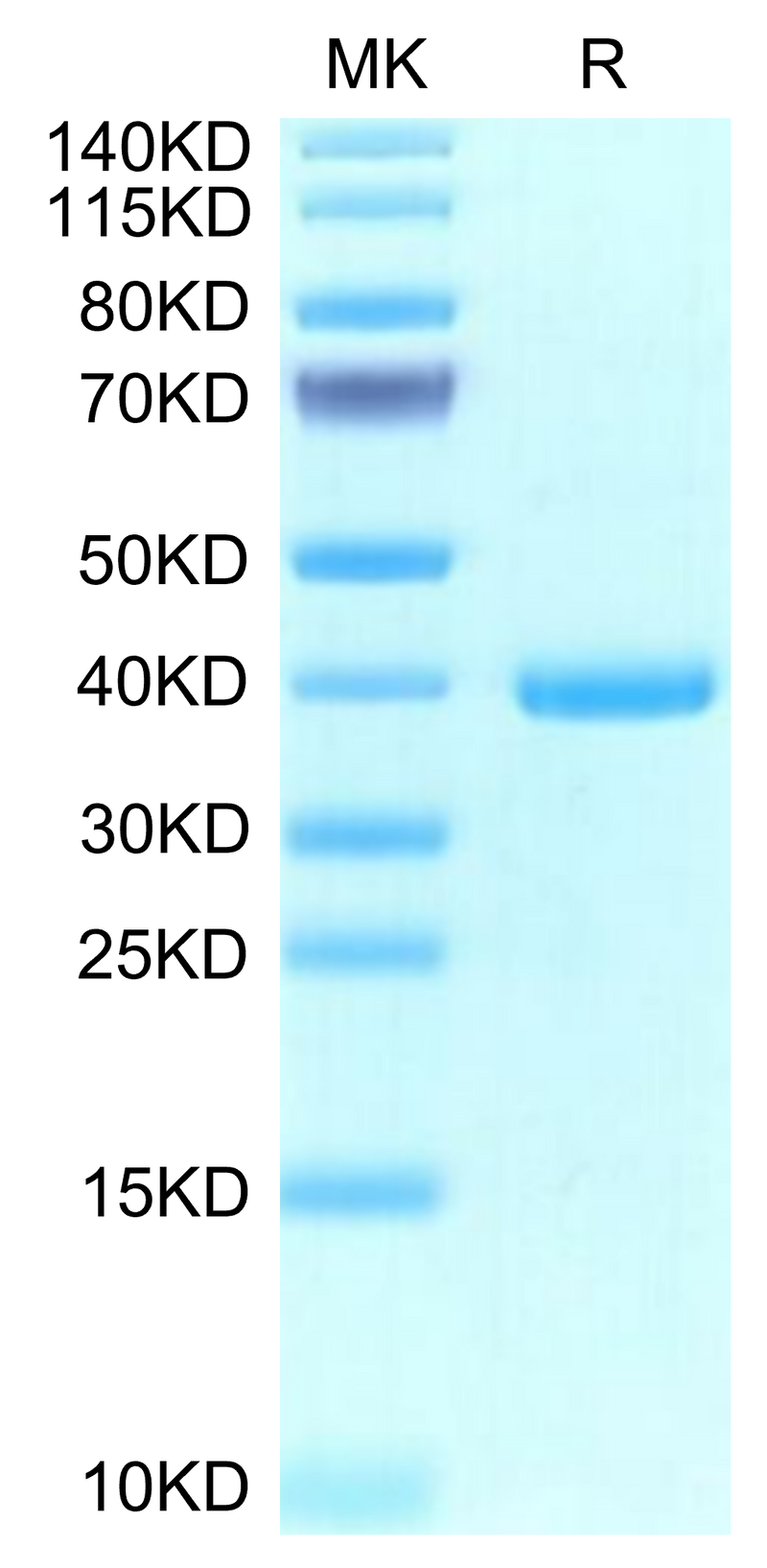 Human EREG on Tris-Bis PAGE under reduced condition. The purity is greater than 95%.Recombinant Human EREG Protein