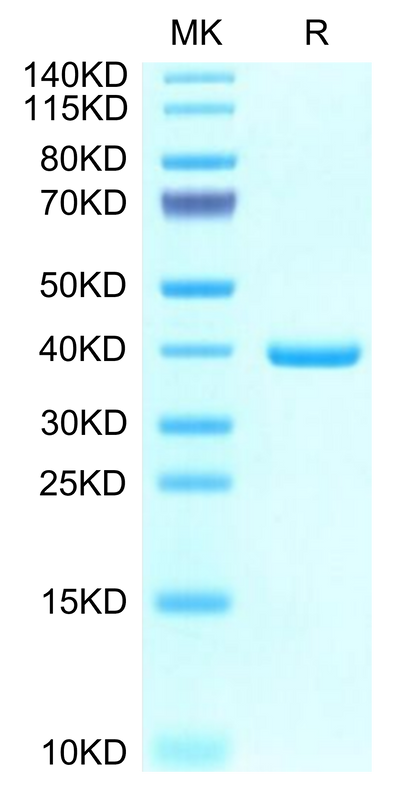 Mouse EREG on Tris-Bis PAGE under reduced condition. The purity is greater than 95%.Recombinant Mouse EREG Protein