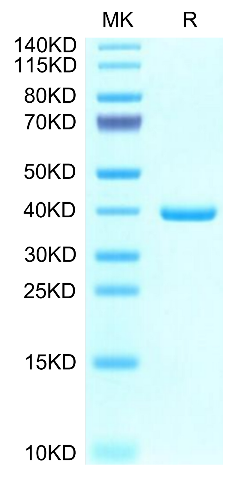 Mouse EREG on Tris-Bis PAGE under reduced condition. The purity is greater than 95%.Recombinant Mouse EREG Protein