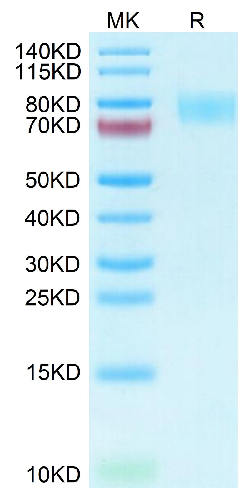 Human Siglec-4a on Tris-Bis PAGE under reduced condition. The purity is greater than 95%.