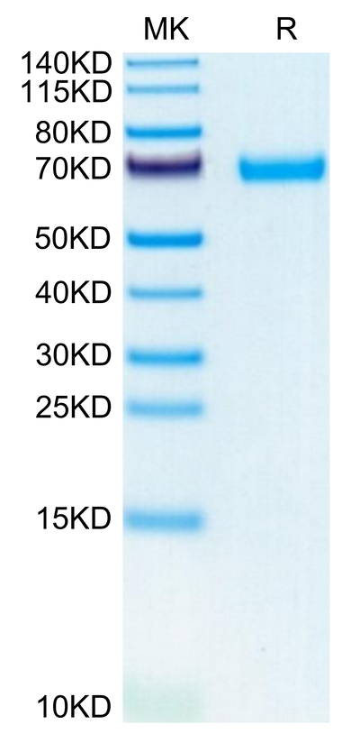 Mouse LIF on Tris-Bis PAGE under reduced condition. The purity is greater than 95%.Recombinant Mouse LIF Protein