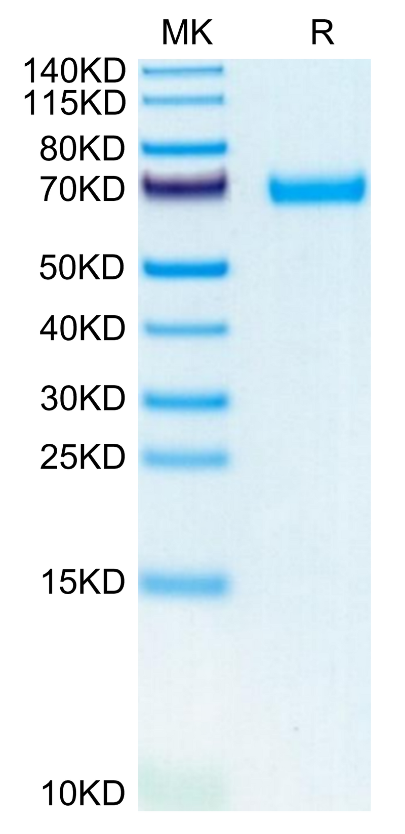 Mouse LIF on Tris-Bis PAGE under reduced condition. The purity is greater than 95%.Recombinant Mouse LIF Protein