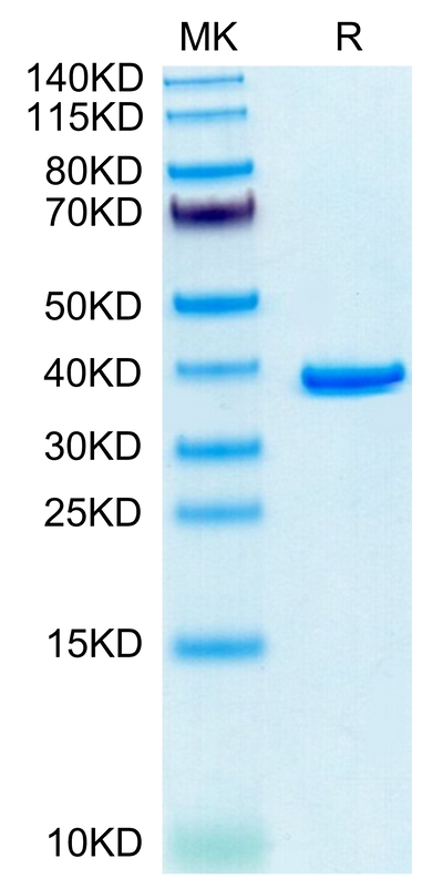 Human ANXA2 on Tris-Bis PAGE under reduced condition. The purity is greater than 95%.Recombinant Human ANXA2 Protein