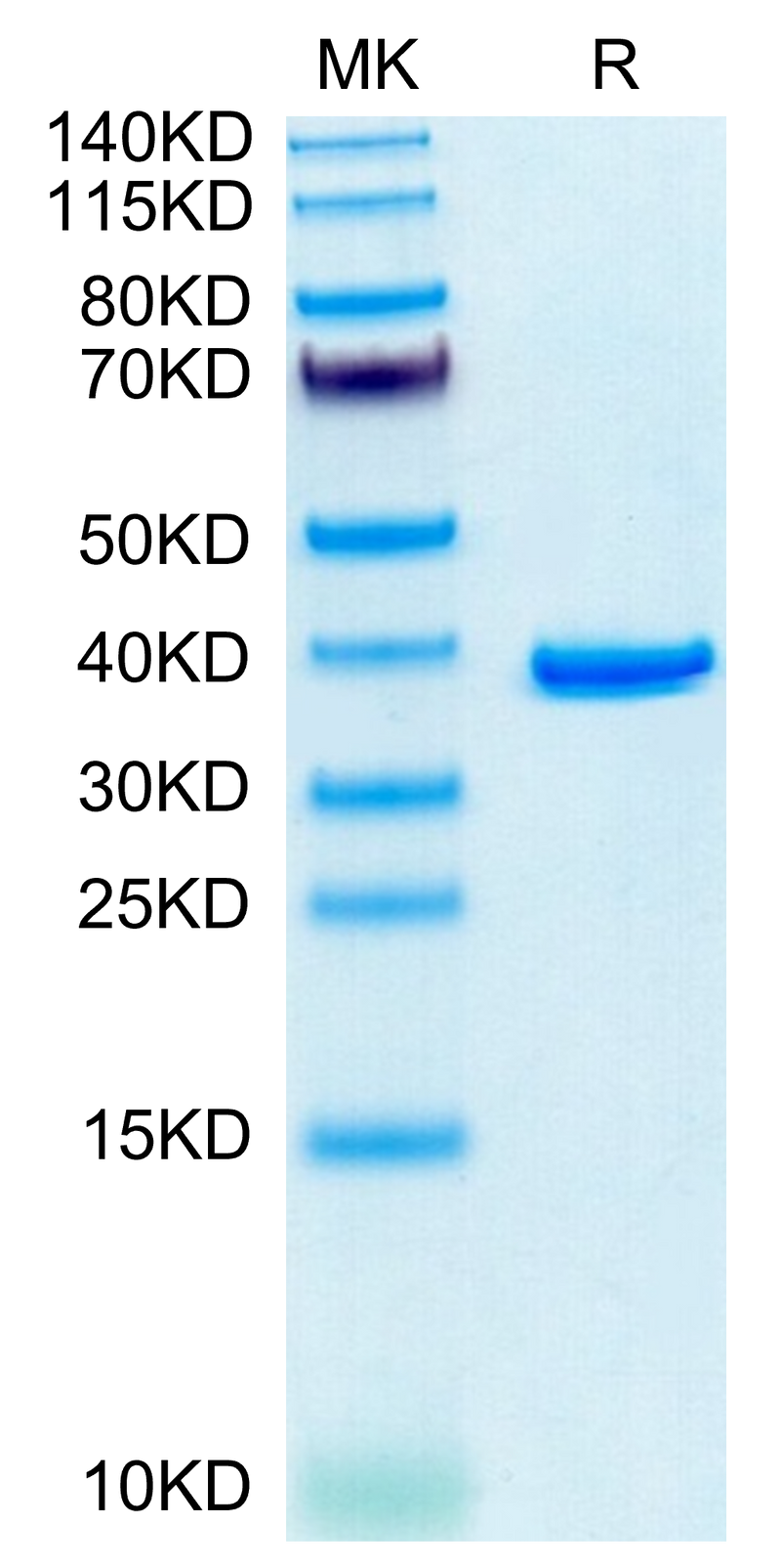 Human ANXA2 on Tris-Bis PAGE under reduced condition. The purity is greater than 95%.Recombinant Human ANXA2 Protein