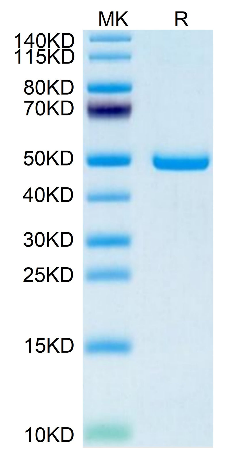 Human SECTM1 on Tris-Bis PAGE under reduced condition. The purity is greater than 95%.Recombinant Human SECTM1 Protein, Active